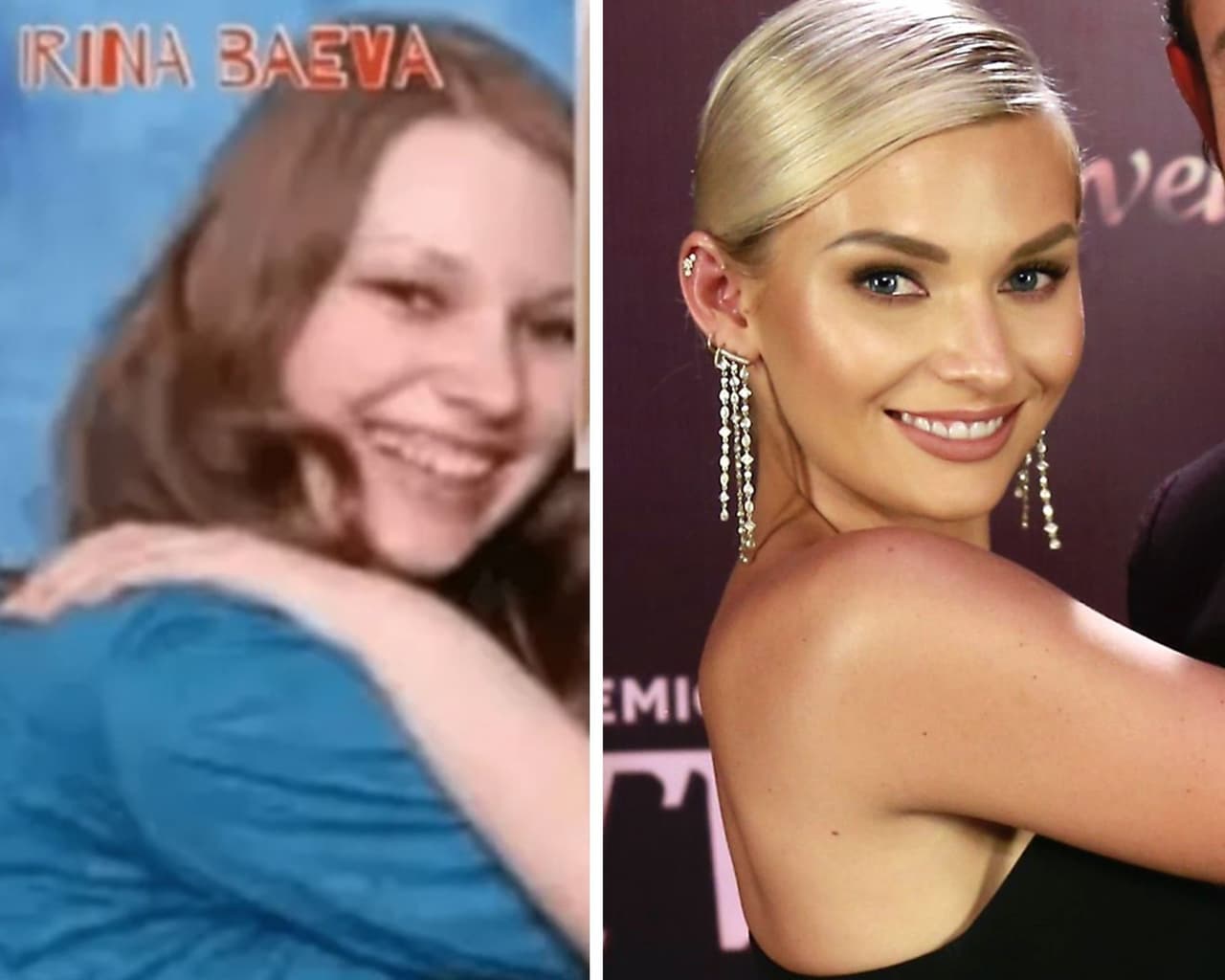 Con ayuda de ortodoncia cualquier sonrisa puede cambiar y lucir de comercial de pasta dental, sin embargo, en el caso de Irina Baeva esta no fue la única transformación estética a la que se sometió. A finales del 2020, 
<a href="https://www.unicable.tv/programas/canal-u/como-se-veia-irina-baeva-antes-de-sus-cirugias">circularon fotos en Internet</a> en las que la prometida de Gabriel Soto lucía un perfil de nariz, quijada y mentón sumamente diferente al que presume ahora.