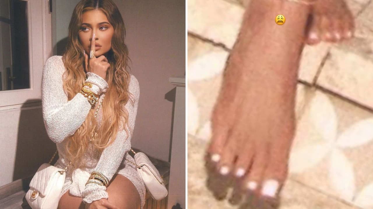 ‘Me lo rompí’: Kylie Jenner tras críticas sobre la ‘deformidad’ de sus pies