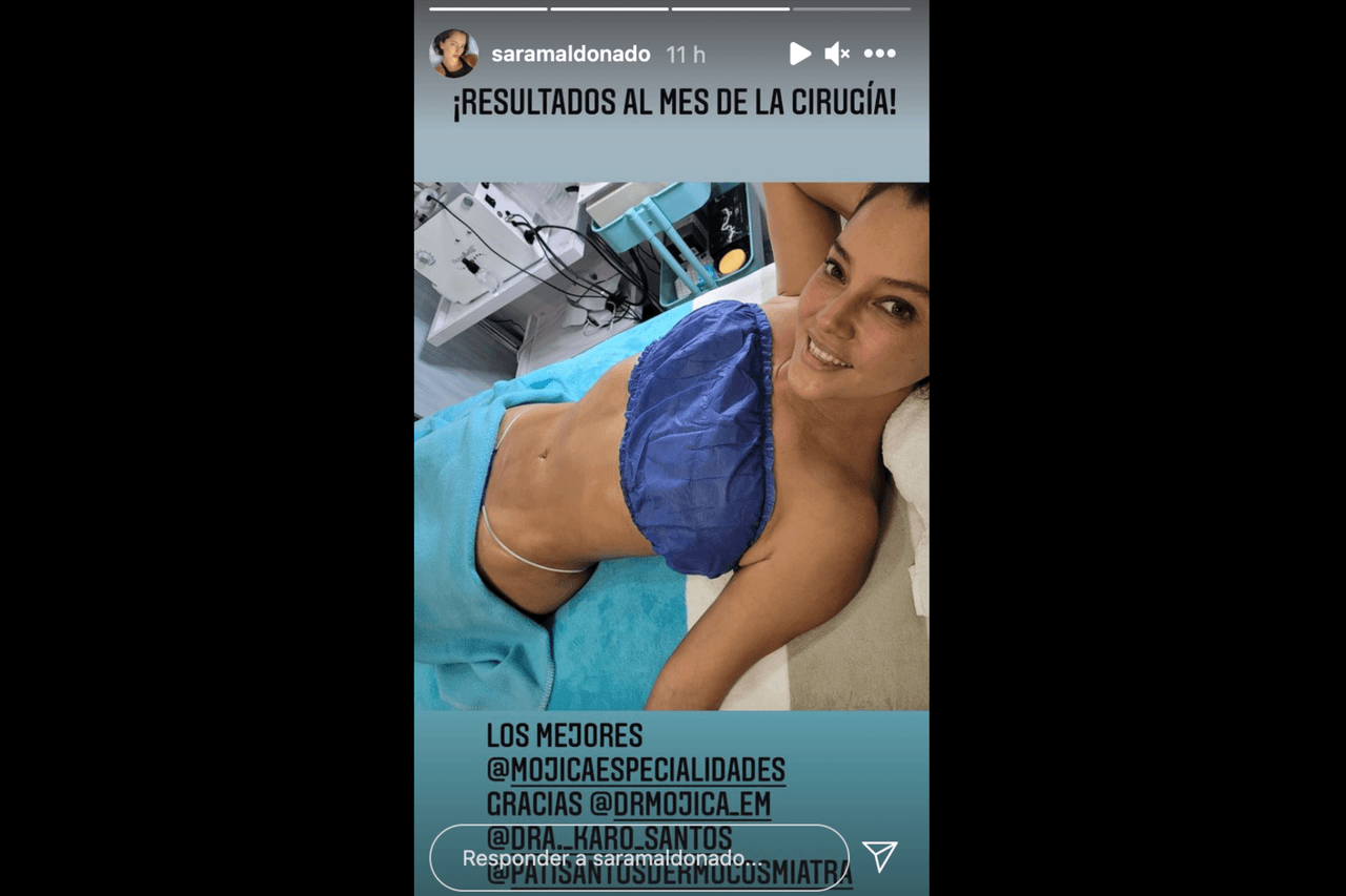Así luce el vientre de Sara Maldonado a un mes de sus cirugías estéticas