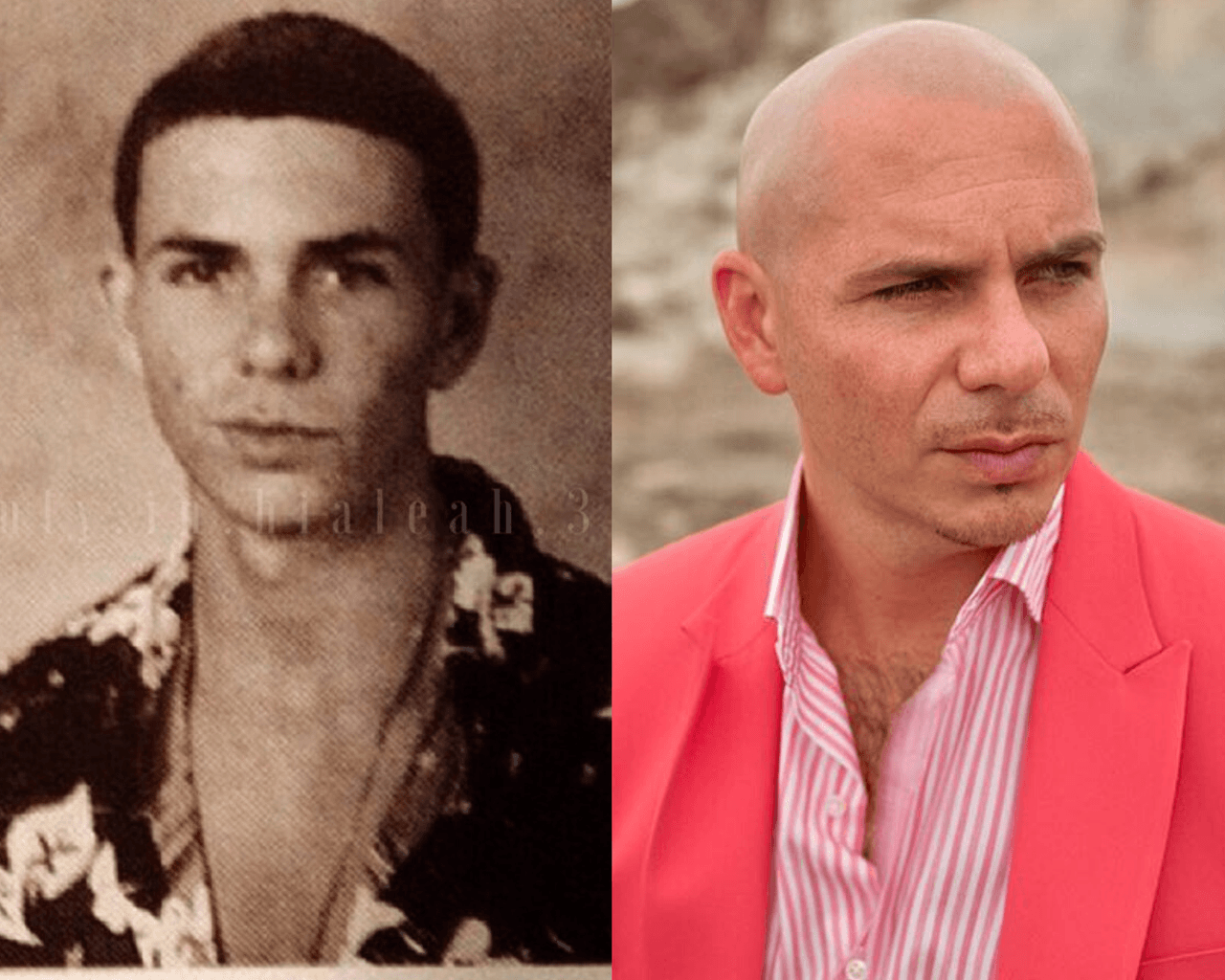 Aparte de que ha hecho cientos de colaboraciones con otros artistas, Pitbull se caracteriza por su falta de cabello. Pero sí, en algún momento tuvo. En su juventud hasta trenzas se hacía.