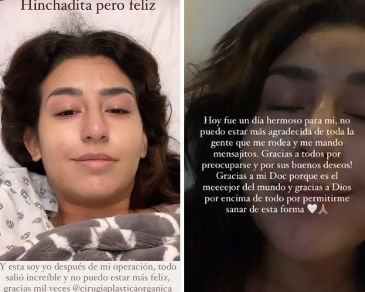 Este martes 18 de febrero, finalmente Romi Marcos se deshizo de sus implantes de seno. Este había sido un deseo que la propia actriz reveló a sus seguidores desde mediados del 2020 y que sucedió a raíz de que tras su pérdida de peso, ya no se sentía cómoda con la talla de 
<i>brasiere </i>que cargaba en su pecho. 
<br>
<br>A través de historias en Instagram, ella mostró su felicidad: "Hoy fue un día hermoso para mí, no puedo estar más agradecida".