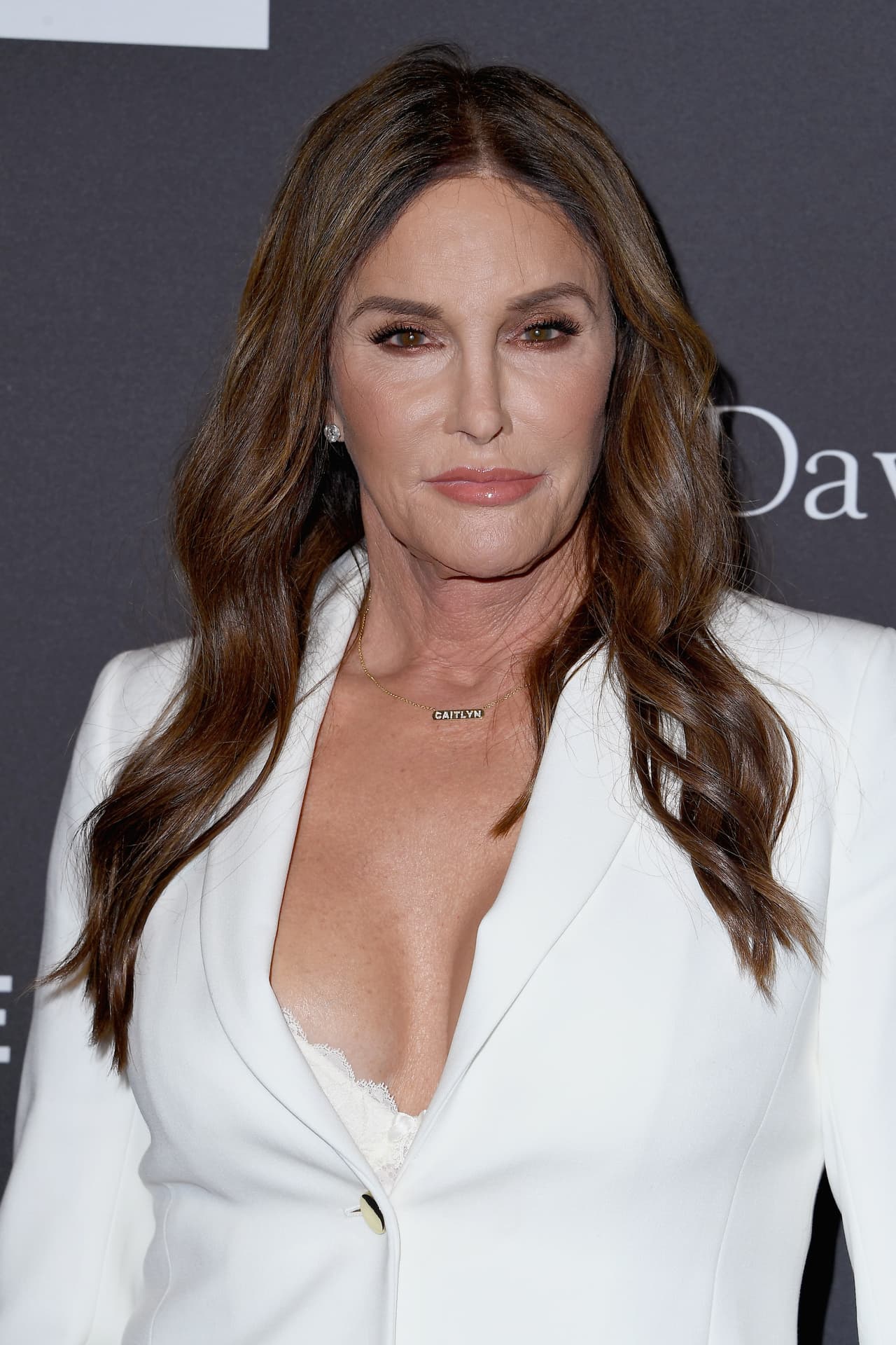 Luego de su transición de reasignación de sexo, Caitlyn Jenner, fue cuestionada en diversas ocasiones sobre su orientación sexual. En uno de los capítulos de su serie de reality show “I Am Cait”, la personalidad de televisión y exdeportista olímpica reveló ser una mujer trans lesbiana.