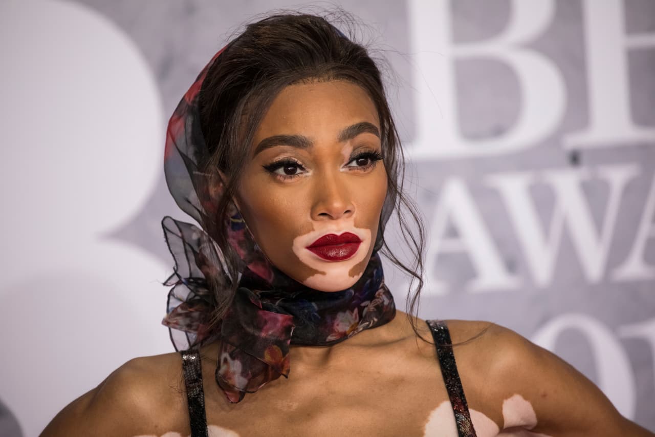 Model Winnie Harlow poses for photographers upon arrival at the Brit Awards in London, Wednesday, Feb. 20, 2019. (Photo by Vianney Le Caer/Invision/AP)