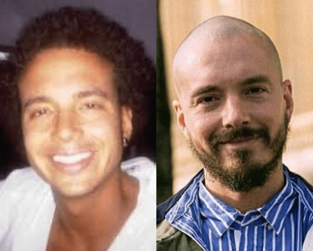 J Balvin se cambia el color de cabello constantemente, lo hemos visto con toda la gama de tonos. ¿Será que por tanto cambio su pelo se está yendo? Sigue siendo muy joven, 34 años, por lo que es probable que ahora que está rapado sea solo un look momentáneo.