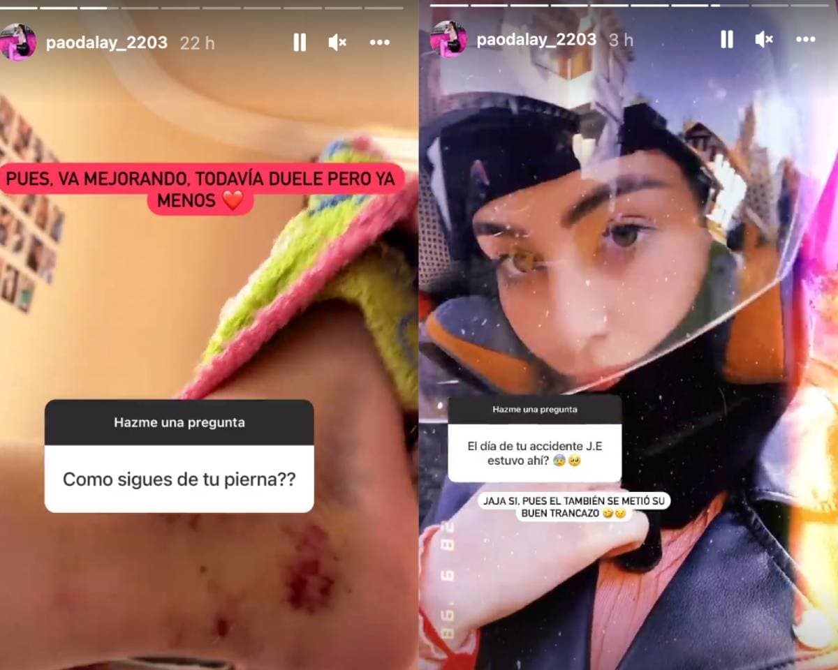 Novia de José Eduardo Derbez tuvo accidente de moto y muestra las heridas que le dejó
