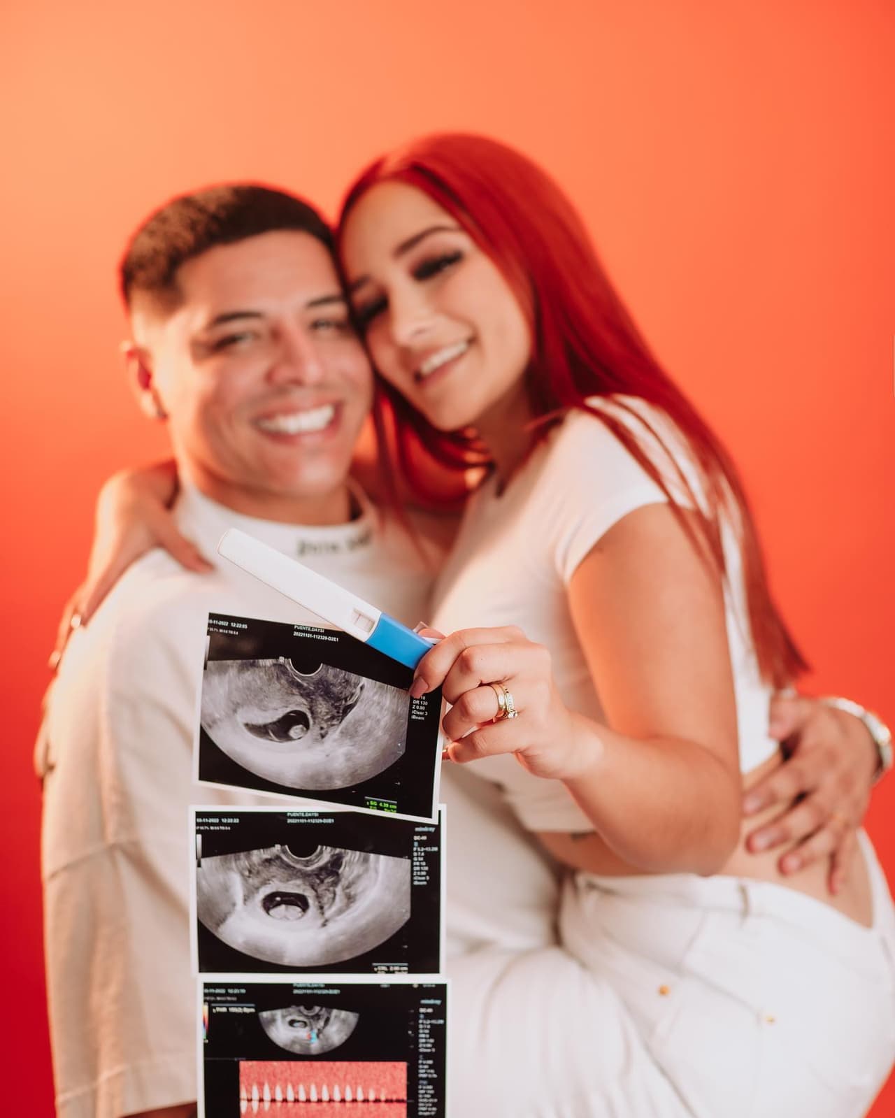 Eduin Caz reacciona entusiasmado al latido del corazón de su tercer hijo