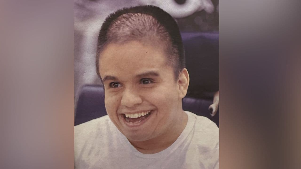 Hombre con parálisis cerebral es llevado a centro especializado y termina con 17 puntos en su cabeza