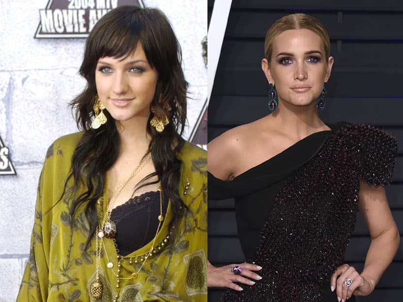 Ashlee Simpson. Según E! News, Joe Simpson, el padre de la cantante, confesó a Fox News que: ‘hubo un problema real con su respiración y se curó’.