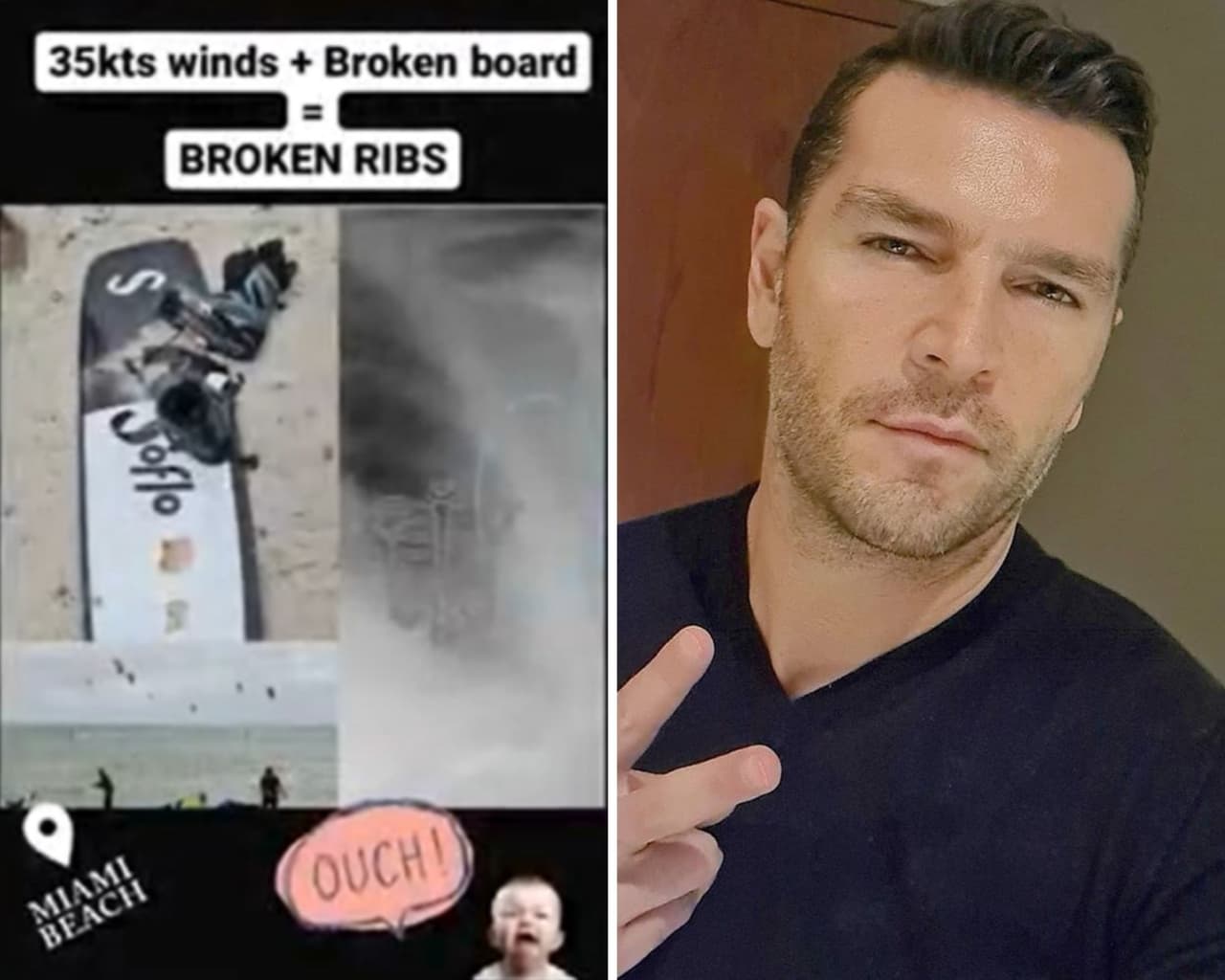 Esposo de Jacky Bracamontes se rompe costillas tras accidente haciendo surf