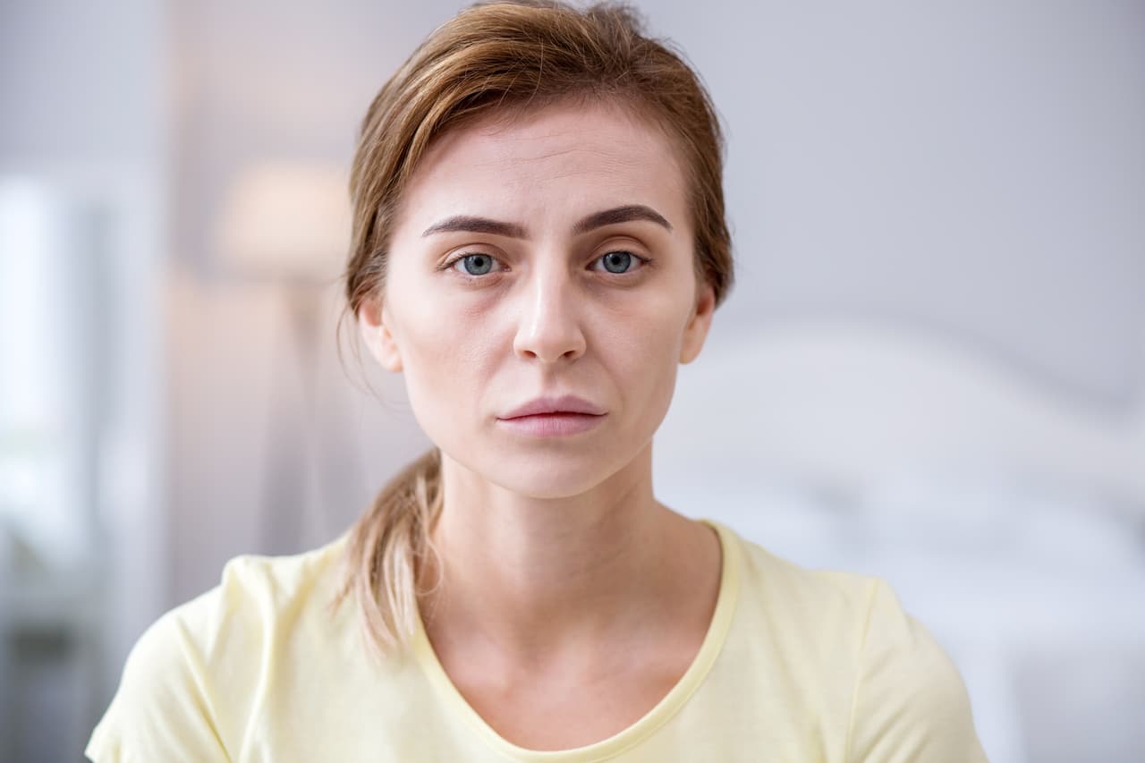 Si tu rostro se ve demacrado o se ha tornado pálido, podría denotar anemia o incluso una enfermedad hepática