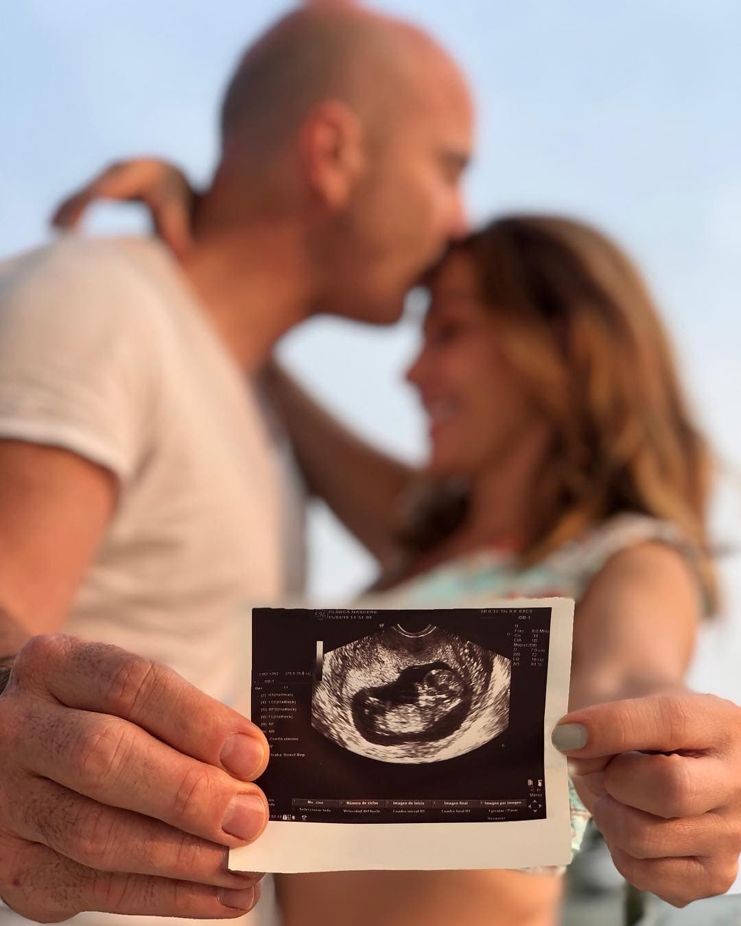 Erika anunció el pasado 28 de abril que esperaba su primer hijo junto a su esposo, Francisco, con quien llegó al altar en julio de 2017.