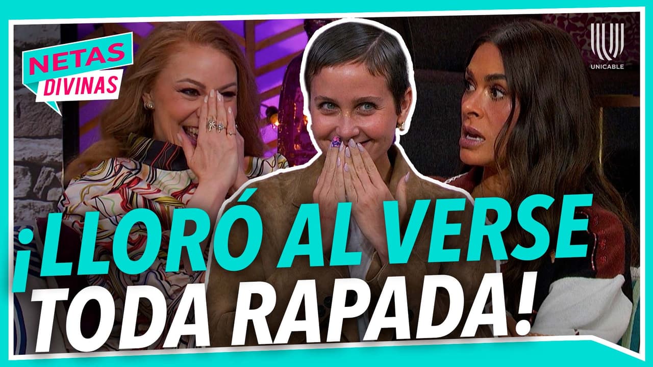 Natasha Dupeyrón reveló el tormento que pasó al quedar PELONA y cómo encontró su feminidad