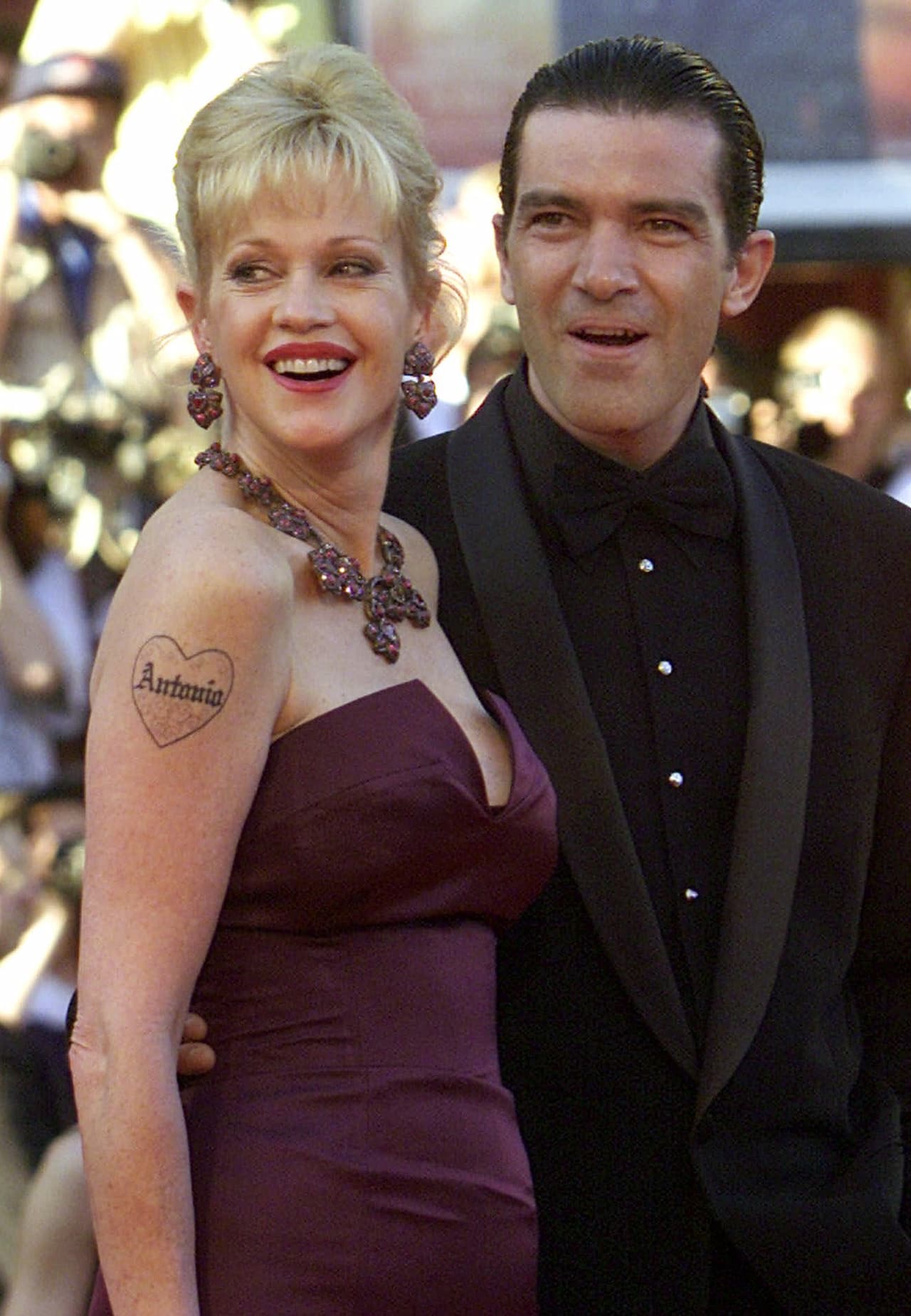 Luego de 18 años de matrimonio, Antonio Banderas y Melanie Griffith anunciaron su separación en 2014, y durante esas casi dos décadas, la actriz llevó grabado en su brazo un gran corazón junto al nombre de Antonio. Para finales de su divorcio, la actriz comenzó el tratamiento para borrar el tatuaje.