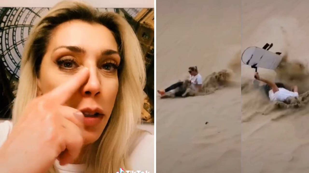 Cynthia Klitbo muestra el ‘porrazo’ que se dio tras practicar skateboarding: Tengo un moretón