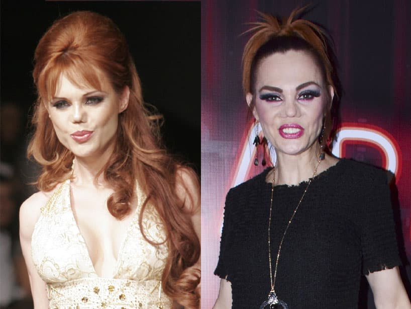 Conoce las tragedias que cambiaron la vida y el rostro de la famosa modelo mexicana.