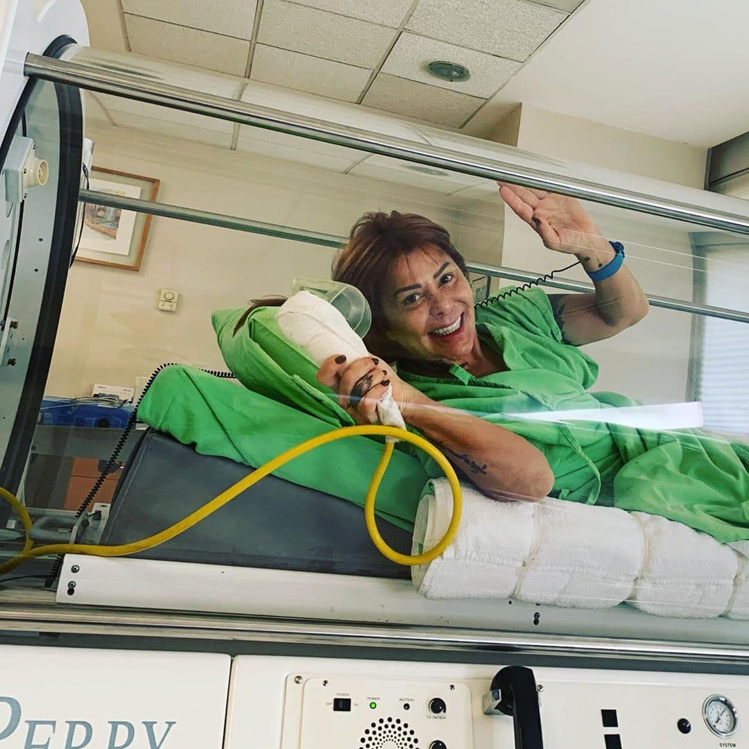 En 2009, Alejandra Guzmán recurrió a Valentina Albornoz, quien le inyectó metil metacrilato que se le encarnó en el músculo y por la que casi muere. Hasta enero de 2019, la cantante seguía padeciendo las duras consecuencias de haberse sometido a un tratamiento para aumentar el tamaño de los glúteos 10 años antes. Tras casi 30 cirugías, la cantante ha podido recuperarse.