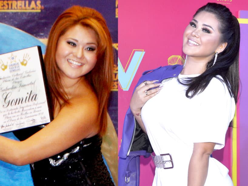 Gomita. La presentadora ha mostrado los resultados de sus cirugías plásticas en sus redes sociales.