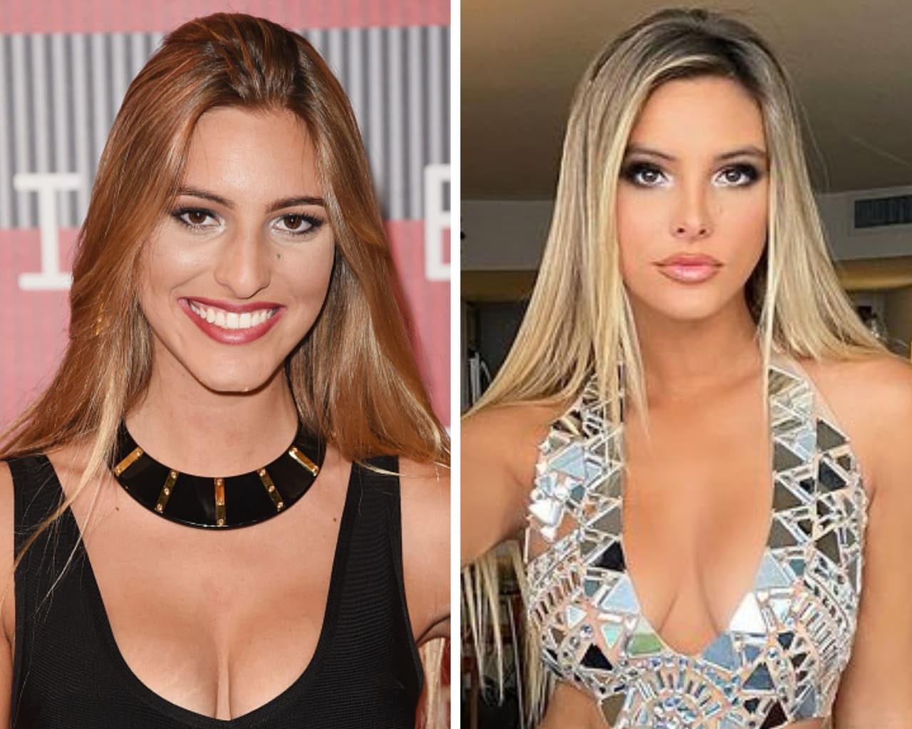 Una famosa latina quien no solo admite su cirugías sino que las presume con orgullo es 
<b>Lele Pons.</b> La estrella de Vine le ha sacado jugo a la transformación que se sometió hace algunos años en la que cambió por completo el perfil de su nariz, compartiendo constantemente fotos en su Instagram mostrando no solo el antes y después, sino tranquila y segura de que se sigue amando tal y como lo hacía antes de su rinoplastia.