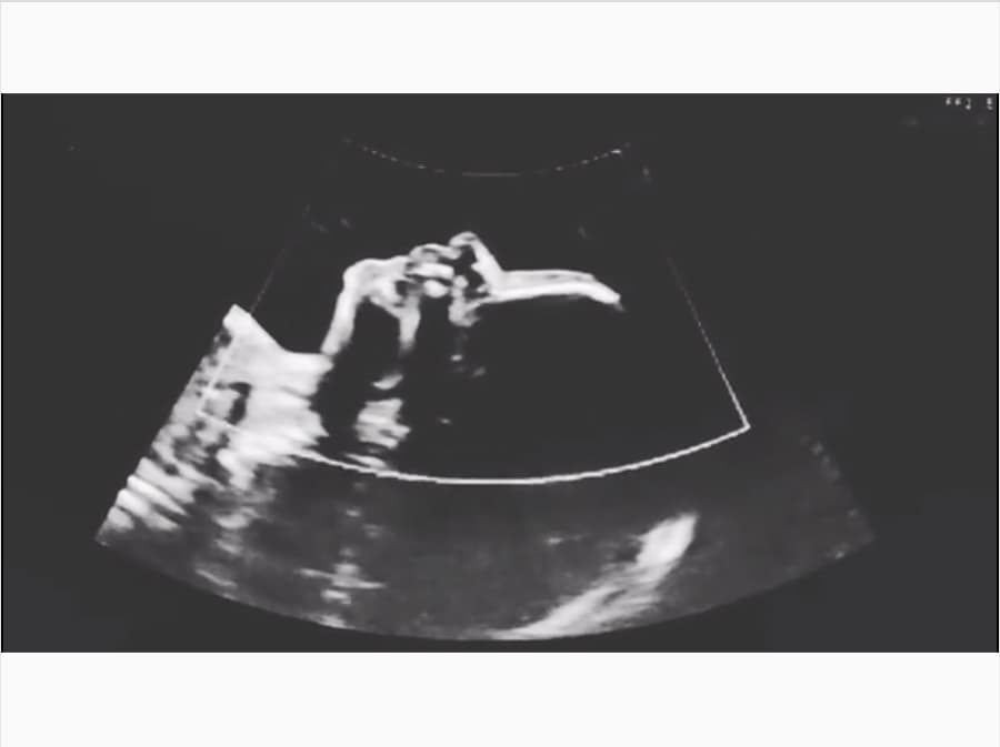 “A pesar que nunca pensé que el amor de mi vida sería una mujer, hace 7 años nos conocimos y el amor nos tomó a ambas por sorpresa, pero dejando a un lado el miedo y el qué dirán, abrí los brazos por completo a mi felicidad. Hoy mi esposa y yo estamos esperando a nuestro primer bebé, una nena hermosa que gracias a Dios viene llena de salud y vida”, expresó Joy el pasado 16 de abril en su cuenta de Instagram compartiendo el ultrasonido de la niña.