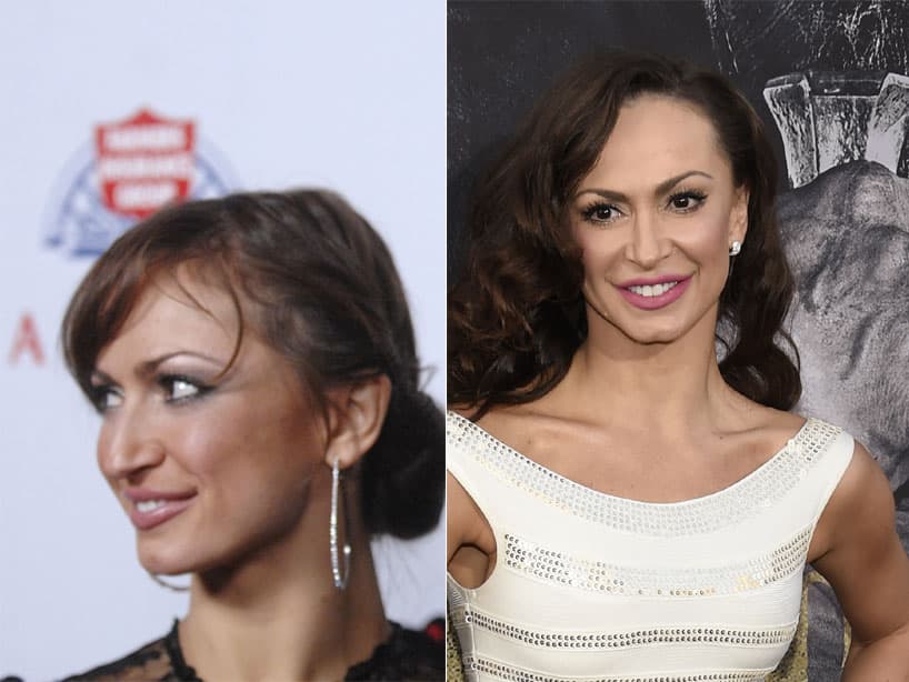 Karina Smirnoff. La bailarina, ganadora de la treceava temporada de ‘Dancing with the stars’, confesó a In Touch Weekly que se sentía genial por su operación. “Es la mejor cosa que me he hecho”.