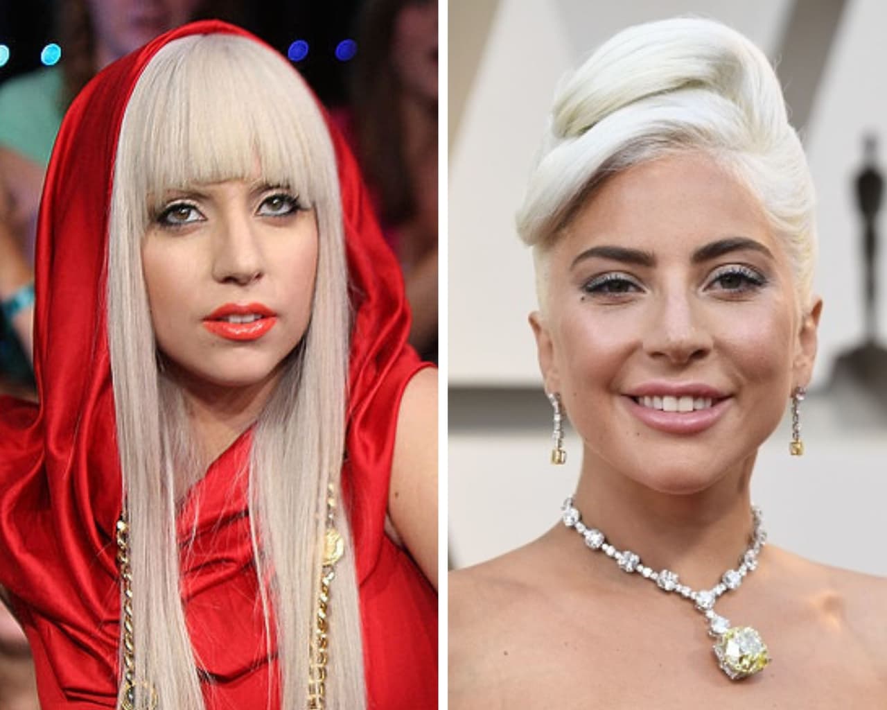 Si bien Lady Gaga asegura que jamás operaría su nariz aguileña, la cantante y actriz no podría negar el cambio que ha logrado a través de los años gracias a rellenos tanto en sus labios, pómulos y mentón, logrando un perfil sumamente diferente al que presumía en el 2009 cuando publicó su álbum debut.