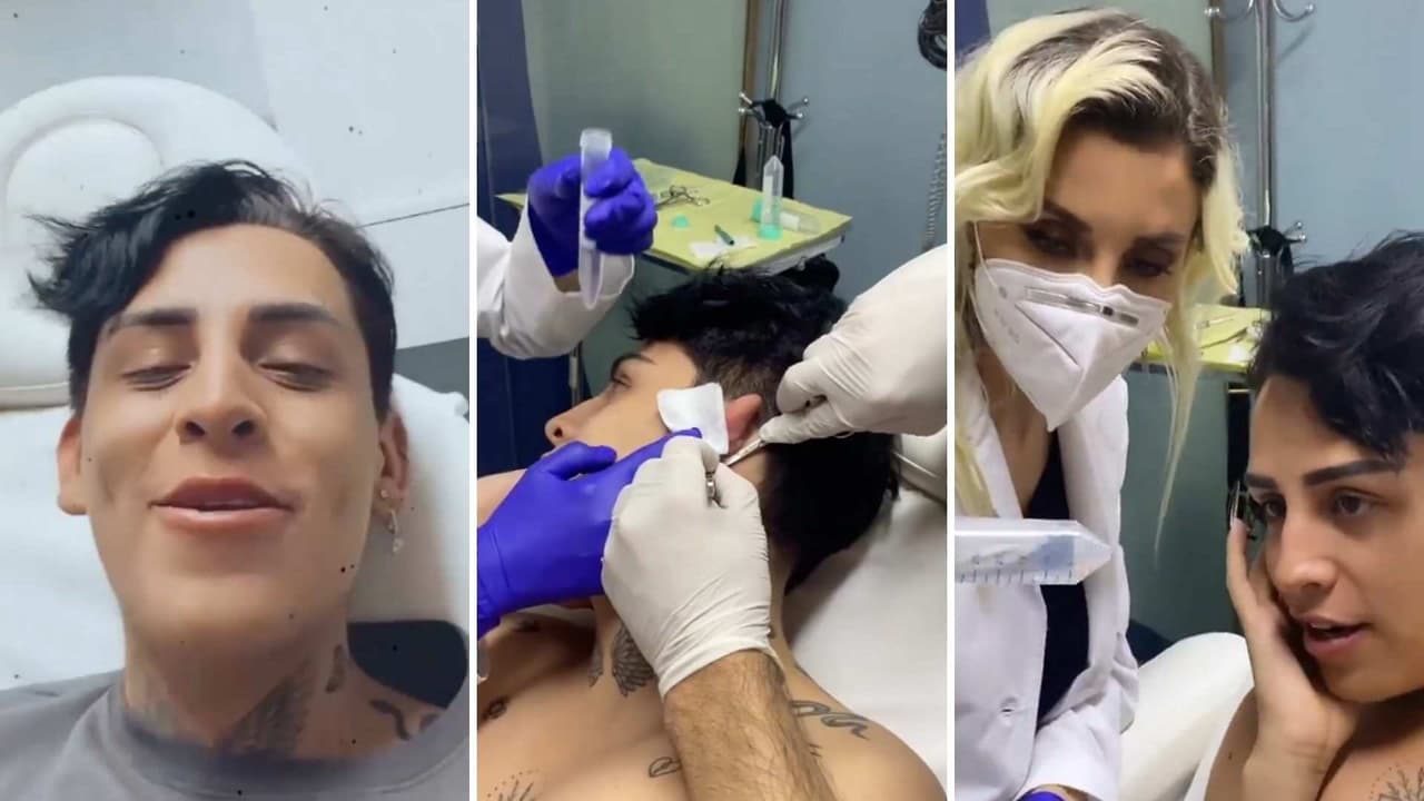 Kunno se somete a nuevo procedimiento estético y enseña cómo le cortan un pedazo de piel para rejuvenecerse