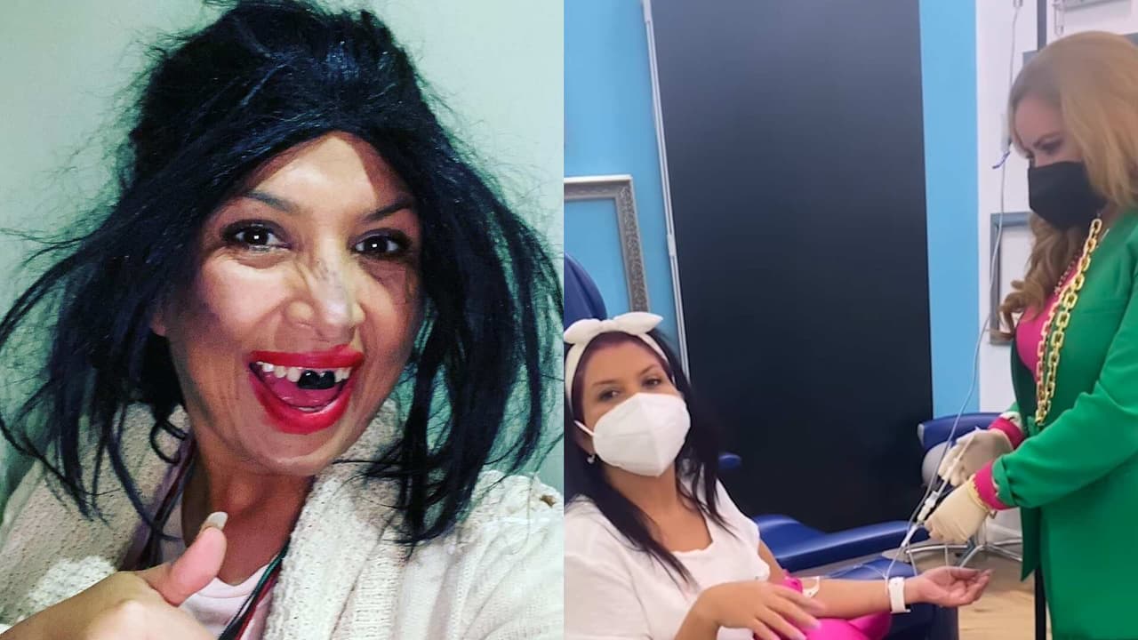 'La Chupitos' se inyecta células madre ¿Qué beneficios tiene?