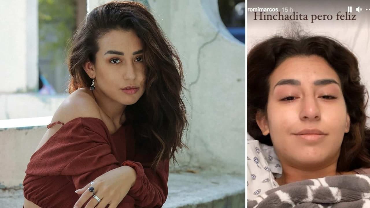 Desde el hospital, Romi Marcos comparte su felicidad tras retirarse sus implantes de seno