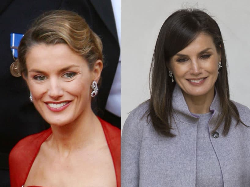 Doña Letizia. La actual reina de España cambió su rostro y a través de un comunicado oficial de la Casa Real española se explicó el motivo. “La intervención ha sido una septorrinoplastia recomendada por los servicios médicos de la Zarzuela para disminuir sus problemas respiratorios”.