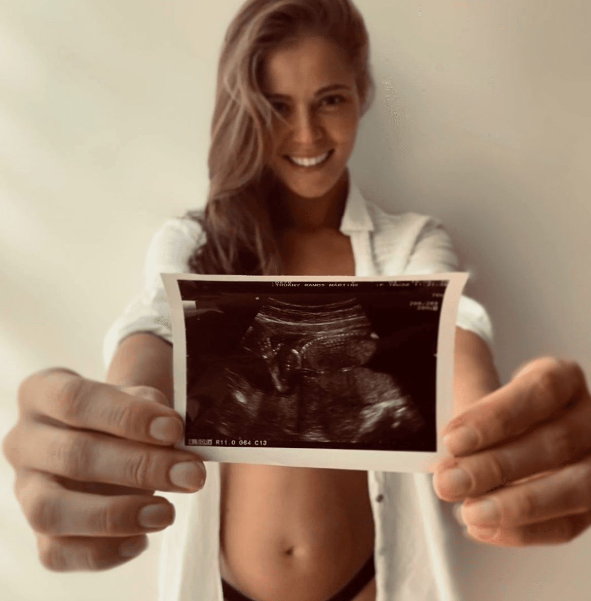 La modelo brasileña feliz mostrando el eco de su pequeña.