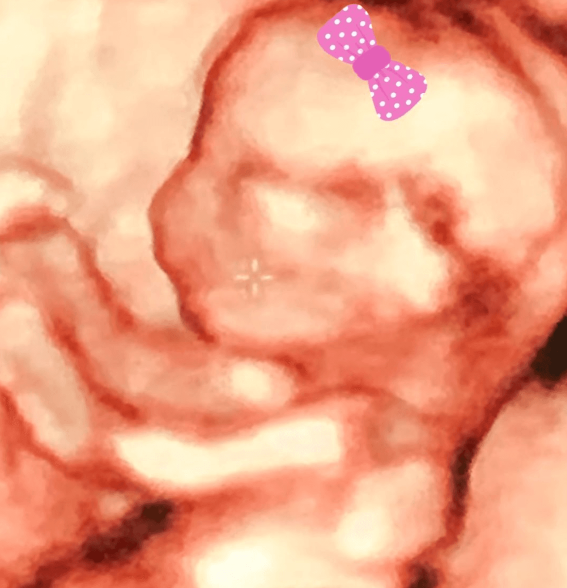 En junio, el conductor de Miembros al Aire anunció que se convertiría nuevamente en papá. Su prometida publicó esta imagen del ultrasonido y reveló que es una niña.
<br>
<br>"Mi cereza del pastel ! Yo feliz con mis 3 (niñas). Gracias @burrovan. Aclaro, mi bebé no es fruto de la cuarentena", escribió Magda en Instagram.