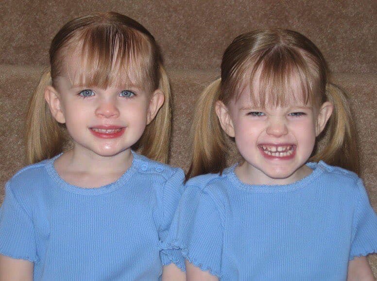 Desde entonces, las gemelas Sheldon han aparecido en otros proyectos de actuación.